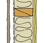 External sound envelope (fibre cement cladding)